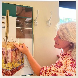 En historie om permanent hårfjerning