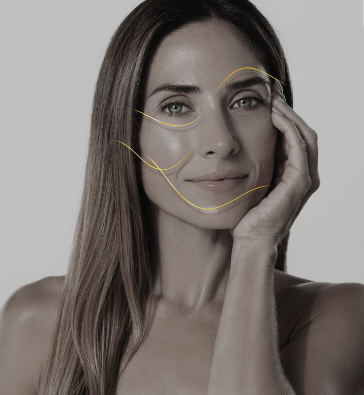 Triple Power Skin Lifting: Løft din klinik med denne non-invasive tråd behandling fra MONTEIL